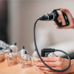 Close-up of the acupuncture medical treatment with special needles